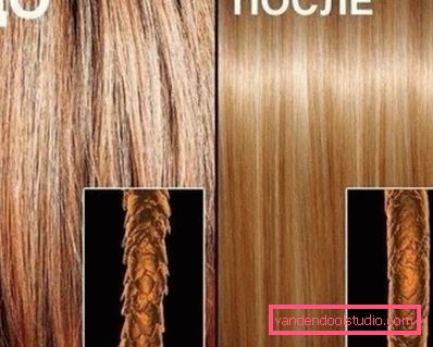 Botox pro vlasy. Vše, co potřebujete vědět o populárním postupu