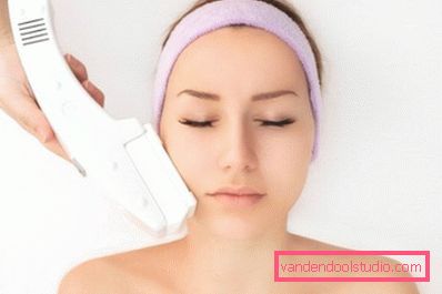 laserový peeling na kůži laserový peeling na kůži